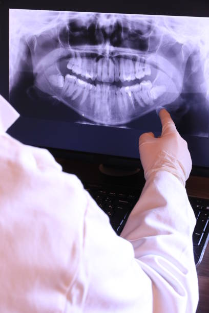 Best Emergency Tooth Extraction in Lincoln Park, NJ